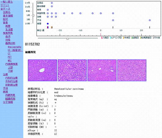 臨床情報の表示画面（病理組織画像）